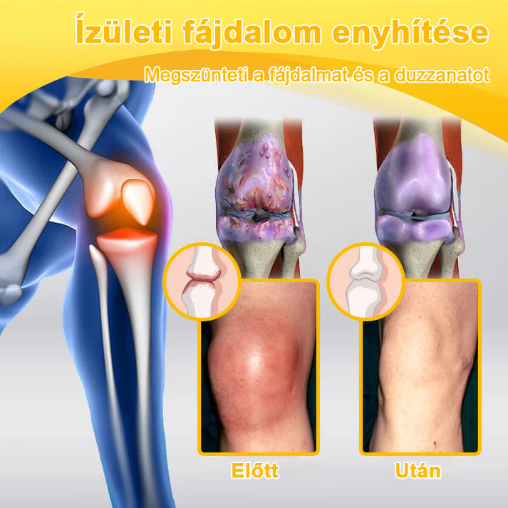 ArthroFree™ 🐝Gydomasis artrito kremas su bičių nuodais ir ciberžole - specialiai sukurtas gydyti ortopedines ligas ir sąnarių skausmus 🍀