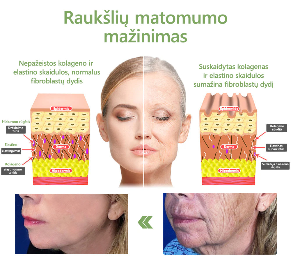 Paskutinės dienos išpardavimas: 70% NUOLAIDA LEFUN® SkinFirming atjauninantis aliejus🧴