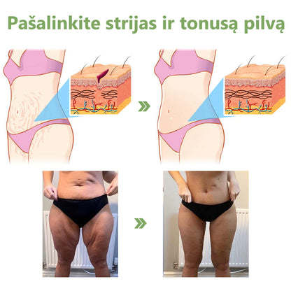 Paskutinės dienos išpardavimas: 70% NUOLAIDA LEFUN® SkinFirming atjauninantis aliejus🧴