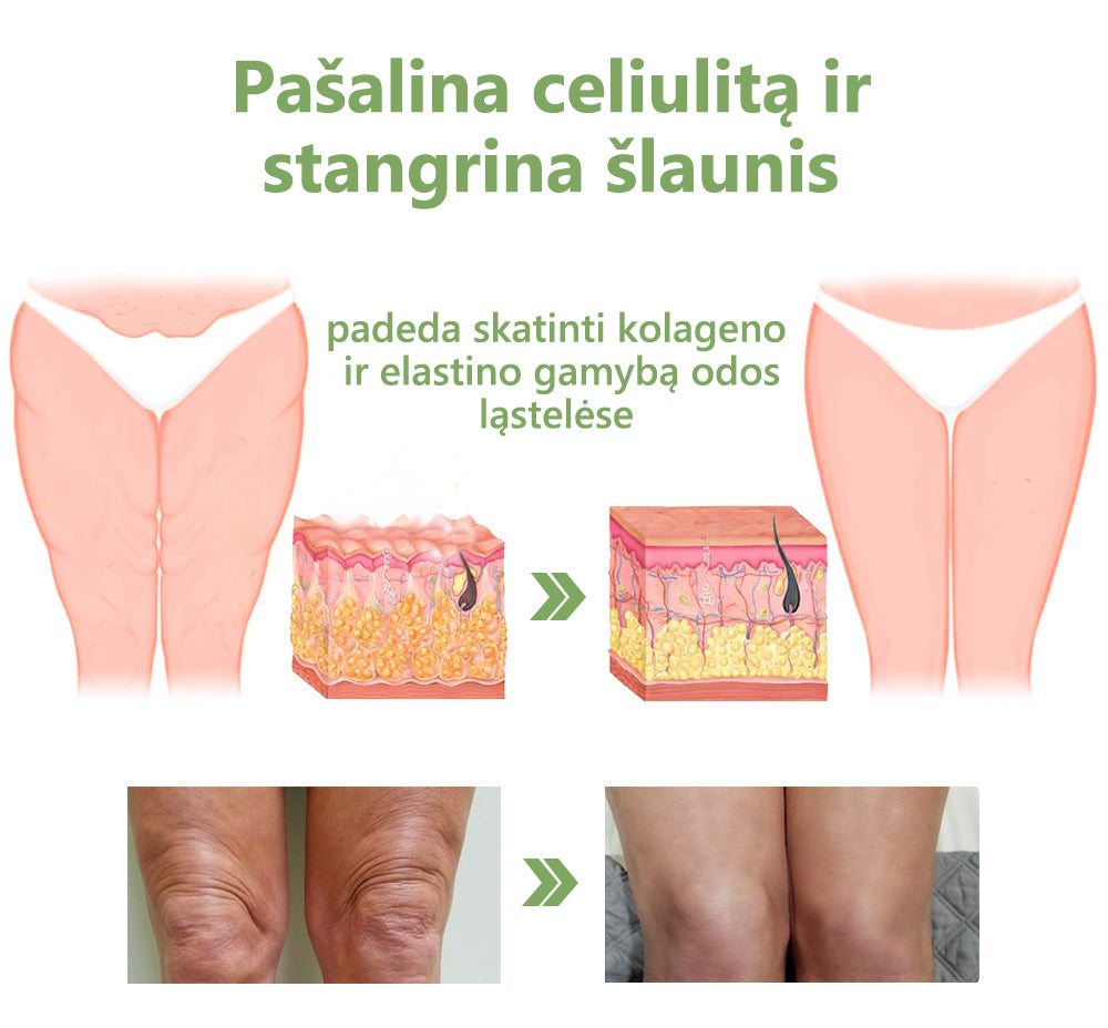 Paskutinės dienos išpardavimas: 70% NUOLAIDA LEFUN® SkinFirming atjauninantis aliejus🧴