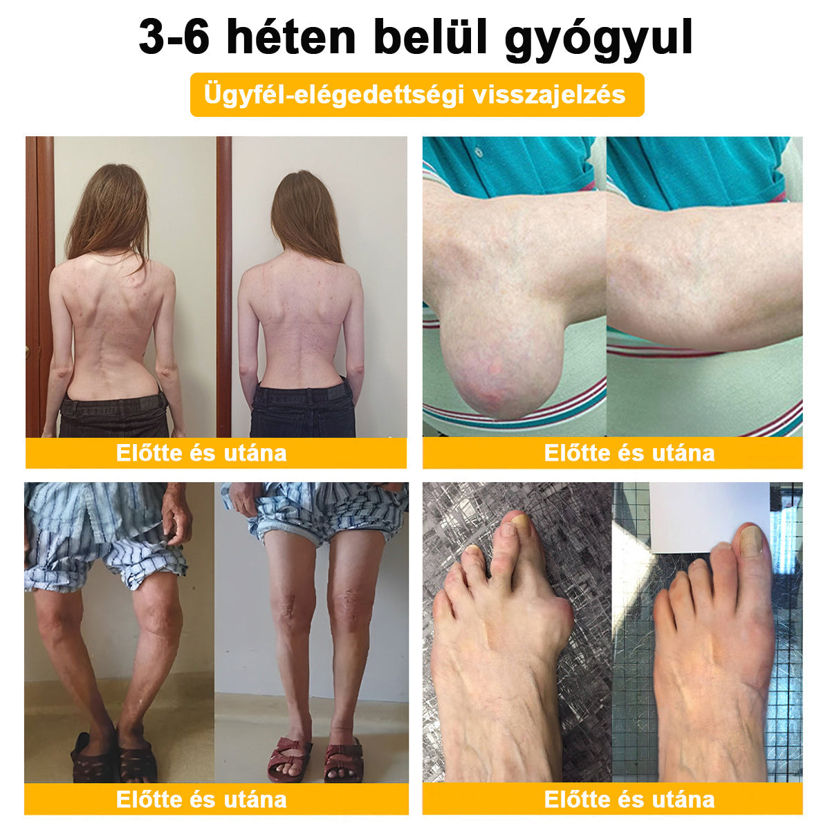 ArthroFree™ 🐝Gydomasis artrito kremas su bičių nuodais ir ciberžole - specialiai sukurtas gydyti ortopedines ligas ir sąnarių skausmus 🍀