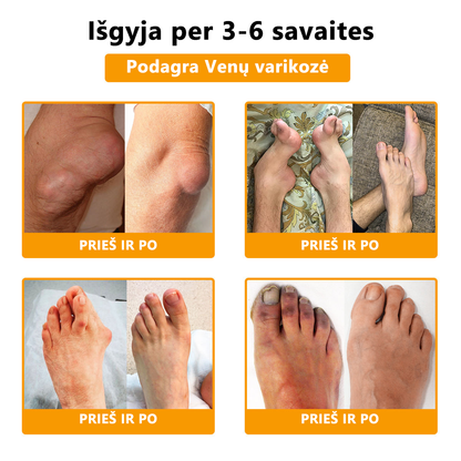 ArthroFree™ 🐝Gydomasis artrito kremas su bičių nuodais ir ciberžole - specialiai sukurtas gydyti ortopedines ligas ir sąnarių skausmus 🍀