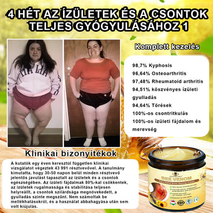 ArthroFree™ 🐝Gydomasis artrito kremas su bičių nuodais ir ciberžole - specialiai sukurtas gydyti ortopedines ligas ir sąnarių skausmus 🍀