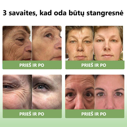 Paskutinės dienos išpardavimas: 70% NUOLAIDA LEFUN® SkinFirming atjauninantis aliejus🧴