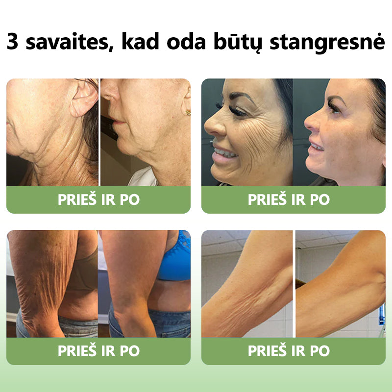 Paskutinės dienos išpardavimas: 70% NUOLAIDA LEFUN® SkinFirming atjauninantis aliejus🧴